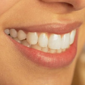 Denti bianchi